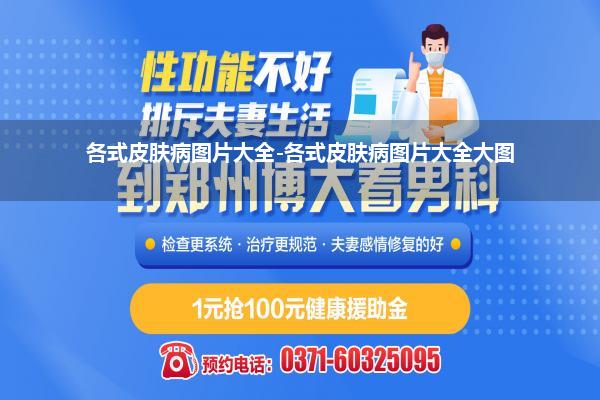 100种疙瘩对照图(各式皮肤病图片大全-各式皮肤病图片大全大图)